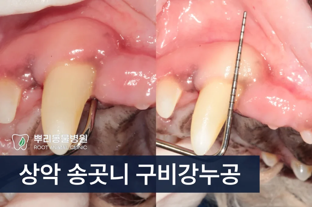 상악 송곳니 구비강누공