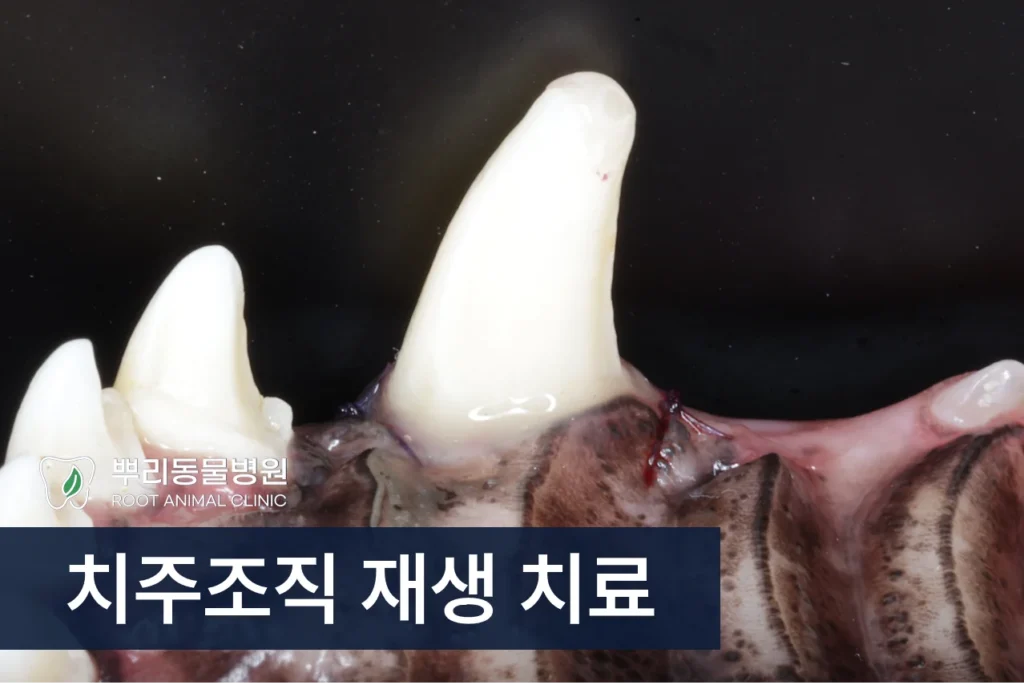 치주조직 재생 치료