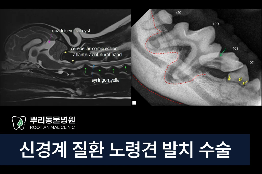 신경계 질환 노령견 발치