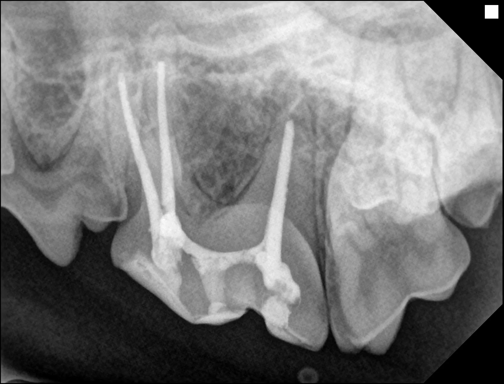 고은강 20250926161845 IO 23