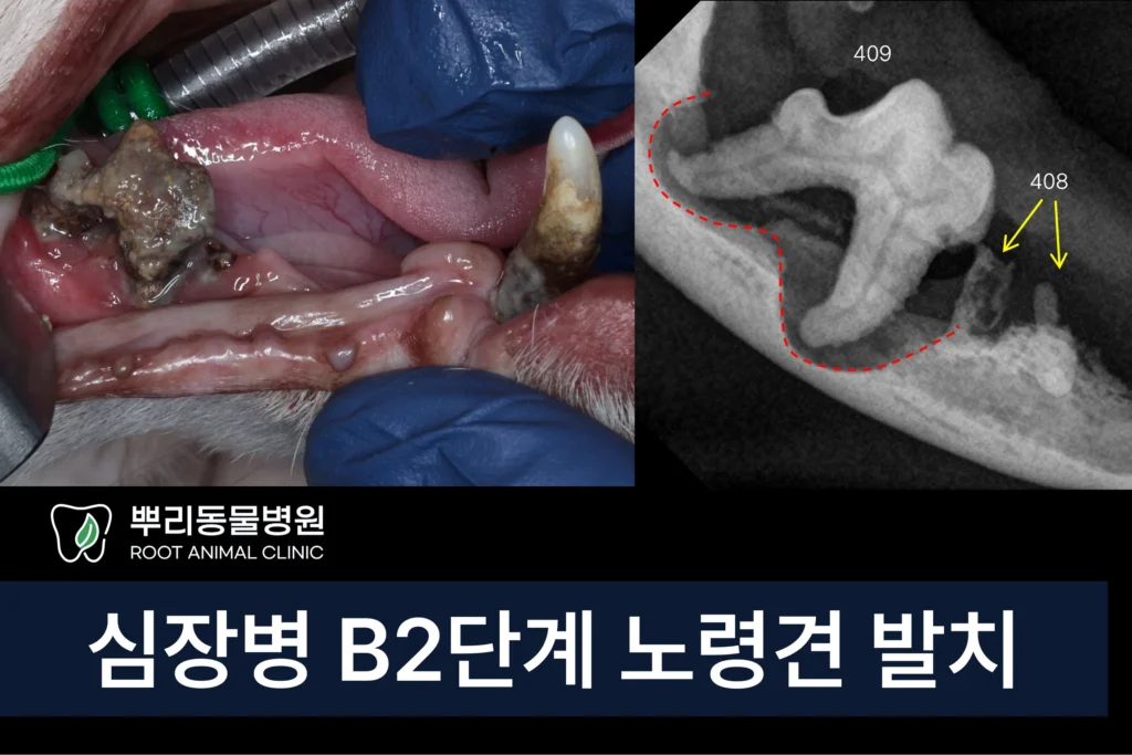 심장병 노령견 턱뼈골절 의심 발치