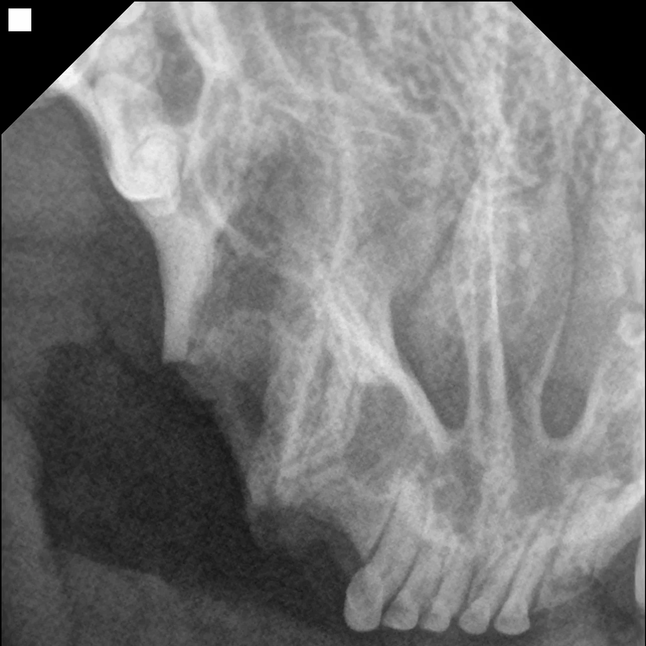 아릉 20251110164448 IO 1