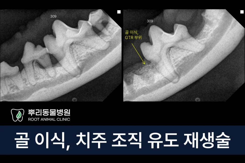 강아지 치주염 골 이식 치주조직 유도 재생술 GTR