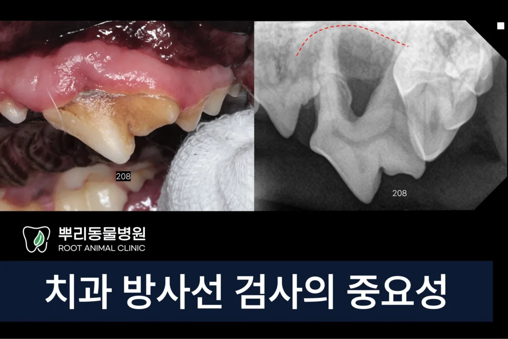 치과 방사선 치주염
